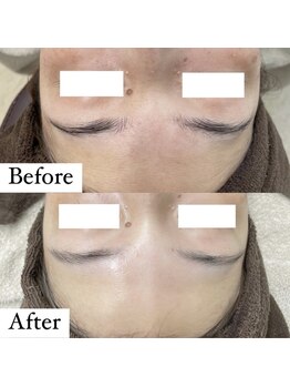 ウルル(ULuLu)/ビフォーアフター