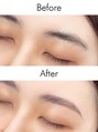 アイム 八王子店(i'm)&nbsp;【Before→After】