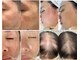 サラシック(salachic)の写真