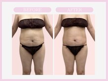 アコガレコガオ 八戸店/