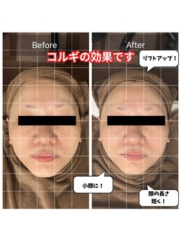 チョアチョア 札幌すすきの店(CHOA-CHOA)/