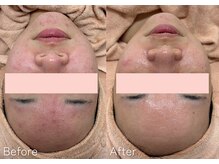 ミュー 多治見店(mieux)/お客様の変化