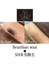 ボーホーアフロ(BOHO AFRO)/VIO脱毛/細かい箇所まで脱毛可能