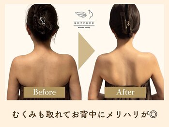 ラフリー 西宮北口院(RUFFREE)/筋膜リリースでむくみ知らず