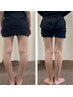 【憧れの美脚ラインへ】太く見える脚を整えるO脚矯正　60分￥2980