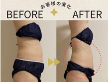 アル(ARU)の雰囲気（デトックスリンパで代謝アップし、痩せやすい身体を。）