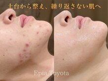 エピア 豊田店(Epia)