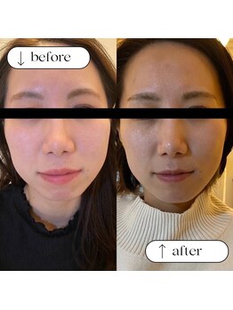 トータルビューティーサロンリア(Li'a)/ビフォー＆アフター