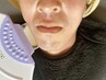 【メンズ】ルミクスA9/全身脱毛（顔、VIO含）2回15000円/初回１時間