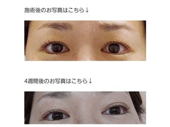 アロマスイーツ(AromaSweets)/まつげパーマ・まつ毛パーマ