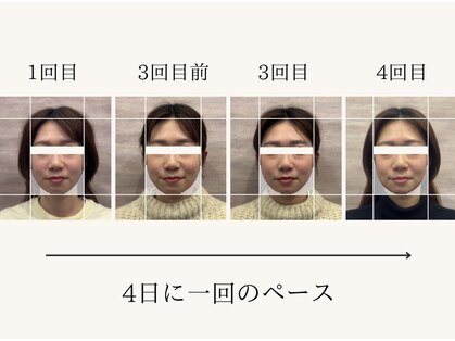 クロニクル鍼灸院(CHRONICLE鍼灸院)の写真