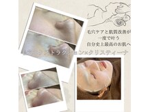ジーンバイピエル 中野店(gene by PIEL)の雰囲気（毛穴エクストラクション×クリスティーナ）