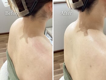 エリー(Ellie)/自慢の肌へと大変身！