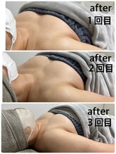 リアン(Lien)/ボンボンバスト