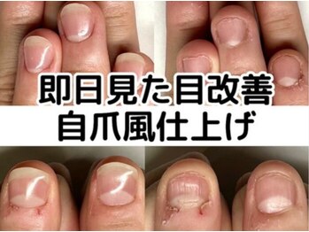 即日から見た目改善、自爪風