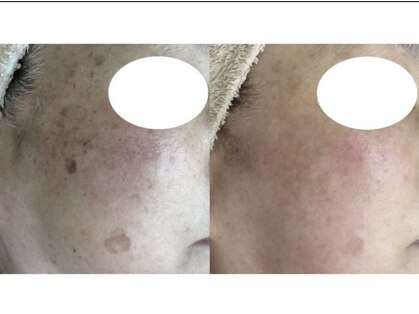 ビューティークリニックコダマ 延岡店の写真