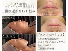 エヌア(nA)