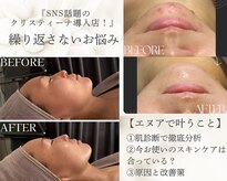 エヌア(nA)