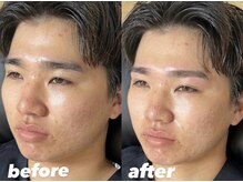 エイチズ(H's)/形だけじゃない！濃さも重要！