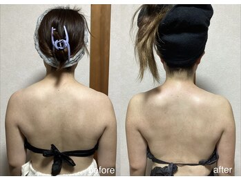 エスポワール(espoir)/小顔コルギ