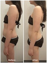 ルミナス/CAVI -CRYO PRO の凄さ！