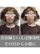 ハリサロンドオフ 心斎橋店(hari salon de off)/即効性を求める方へ