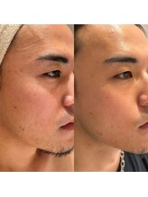 ポーラ ザ ビューティ アピタ千代田橋店(POLA THE BEAUTY)/メンズエステ