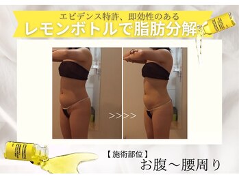 エステティックサロン フェアリー(ESTHETIC SALON FAIRLY)/小顔＊レモンボトル導入店