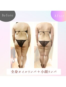 リアン(Lien)/before after