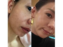 ベリッシマ(Bellissima)の雰囲気（北区で艶肌なりたい方は私まで☆インスタ→bellissima_kanae）