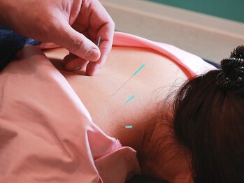 旭堂/肩甲骨はがしと全身の鍼灸 90分