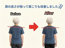 のなか整体院/整体 Before→After