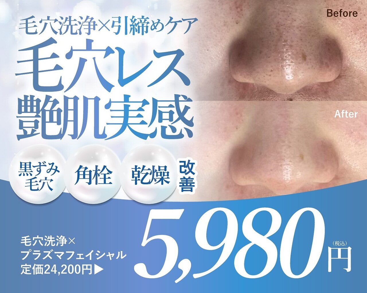 大阪府で毛穴洗浄・毛穴吸引が人気のエステサロン｜ホットペッパー