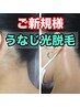 ☆うなじ光脱毛☆《男女OK》¥8,800→¥4,400