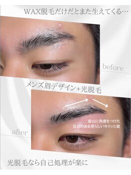 リノア(Linoa)/メンズ眉毛ビフォーアフター