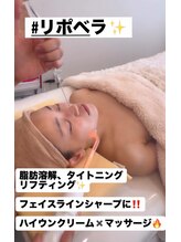 マイントゥー(mine too)/リポベラ小顔