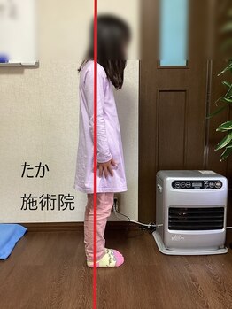 たか施術院/子供の姿勢矯正