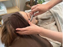 ナネア(nanea)の雰囲気（産毛がなくなり1トーン明るいお肌へ＊）