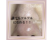 ヒペリカムリリー(hypericum_lily)の雰囲気（毛穴ごっそりツルツルにします。）
