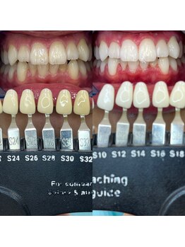 トウキョウスワーズ 池袋店(TOKYO SWRS)/#ホワイトニング #池袋 #渋谷