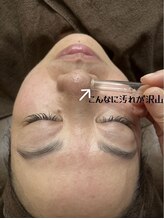 A&A 小山VAL店/毛穴