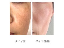リアン(Lien)