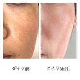 リアン(Lien)
