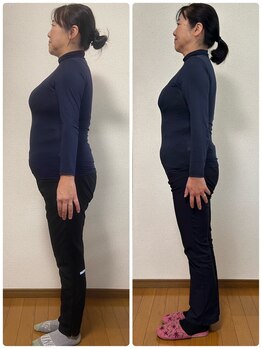 カノン(KANON)/ビフォーアフター