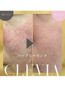 クレビア(Clevia)/Clevia-クレビア