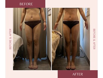 リラル 茅ヶ崎店(RERAR)/ウエストも足もスッキリ！