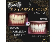 白い歯は自分で手に入れられる！白い歯を取り戻しませんか？