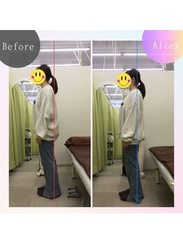 アミーゴ整体院/ビフォーアフター