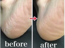 ゾゾ イリプレッセブル(ZOZO irreplaceable)