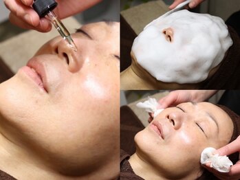 ピウ(piu)の写真/気になり始めたシミしわに♪大人気ハーブピーリングやレチノールピールであなたのお悩みに徹底アプローチ！